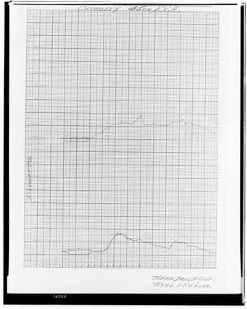 C1.1 - Charts miscellaneous - Load Chart